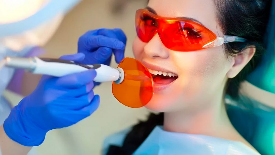 Laser Teeth Whitening
