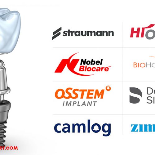 Dental Implant Brands and Features